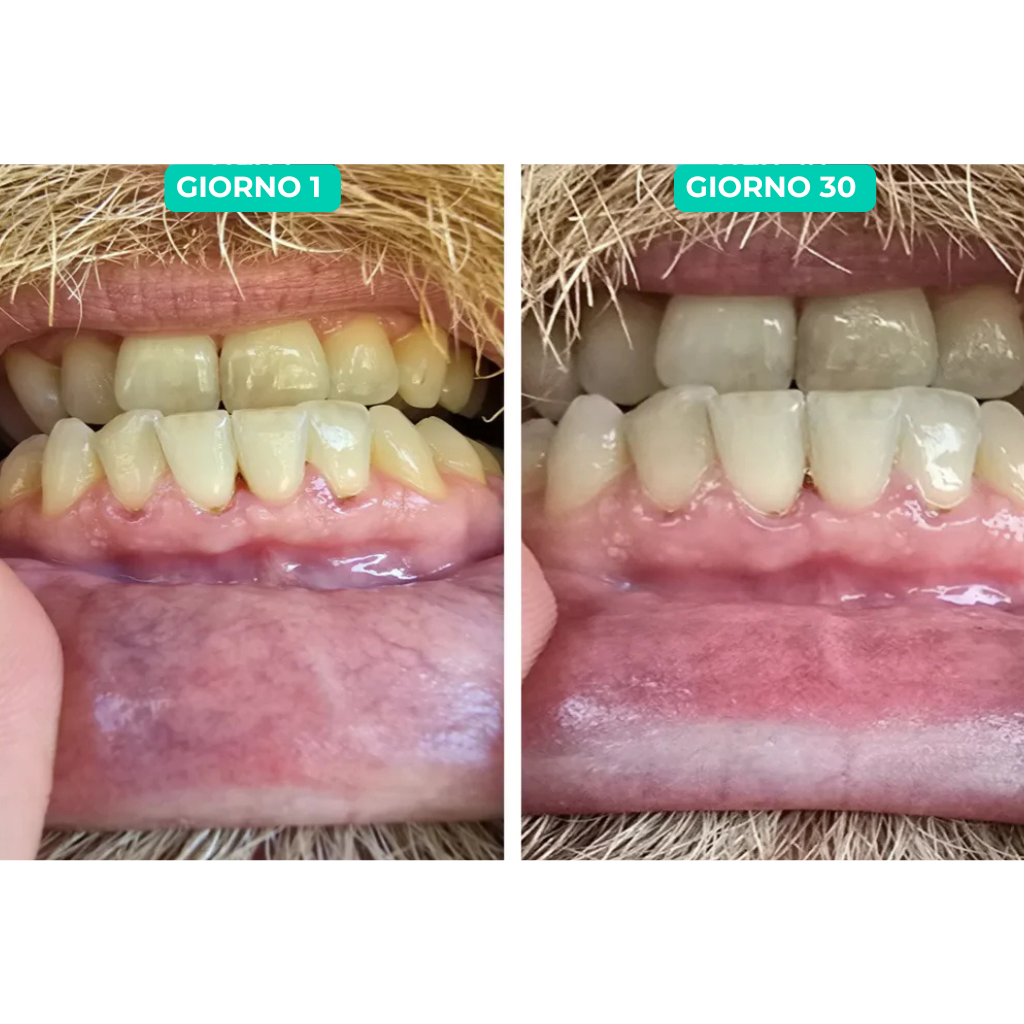 Lumident - GOMMA RIMINERALIZZANTE PER CARIE, ALITO CATTIVO, DENTI INGIALLITI E GENGIVITE