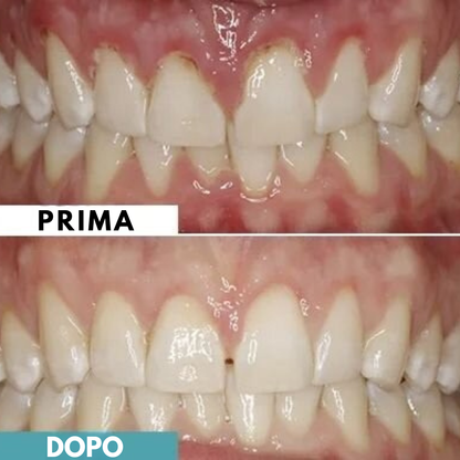 Lumident - 18 Gomme da Masticare Rimineralizzanti contro carie e gengive infiammate (Gusto Menta)